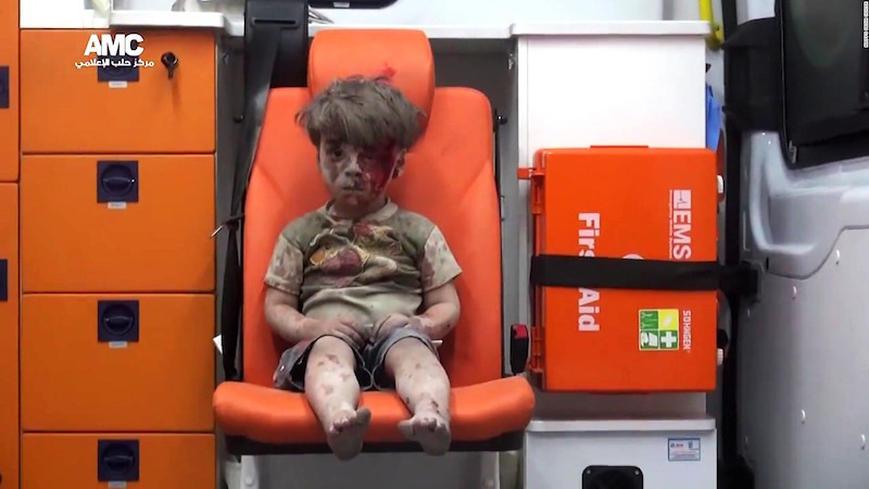 Syrian boy Omran Daqneesh. Credit: Aleppo Media Center.