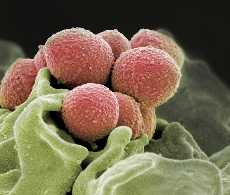 Scanning electron microscope image of Staphylococcus pyogenes bacteria (pink). Credit: NIH National Institute of Allergy and Infectious Diseases